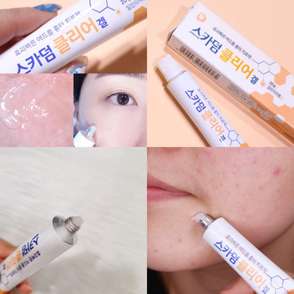 Scarderm Clear Gel 10g/20g, Korea Acne scar care exactly same ingredients and contents as Noscarna