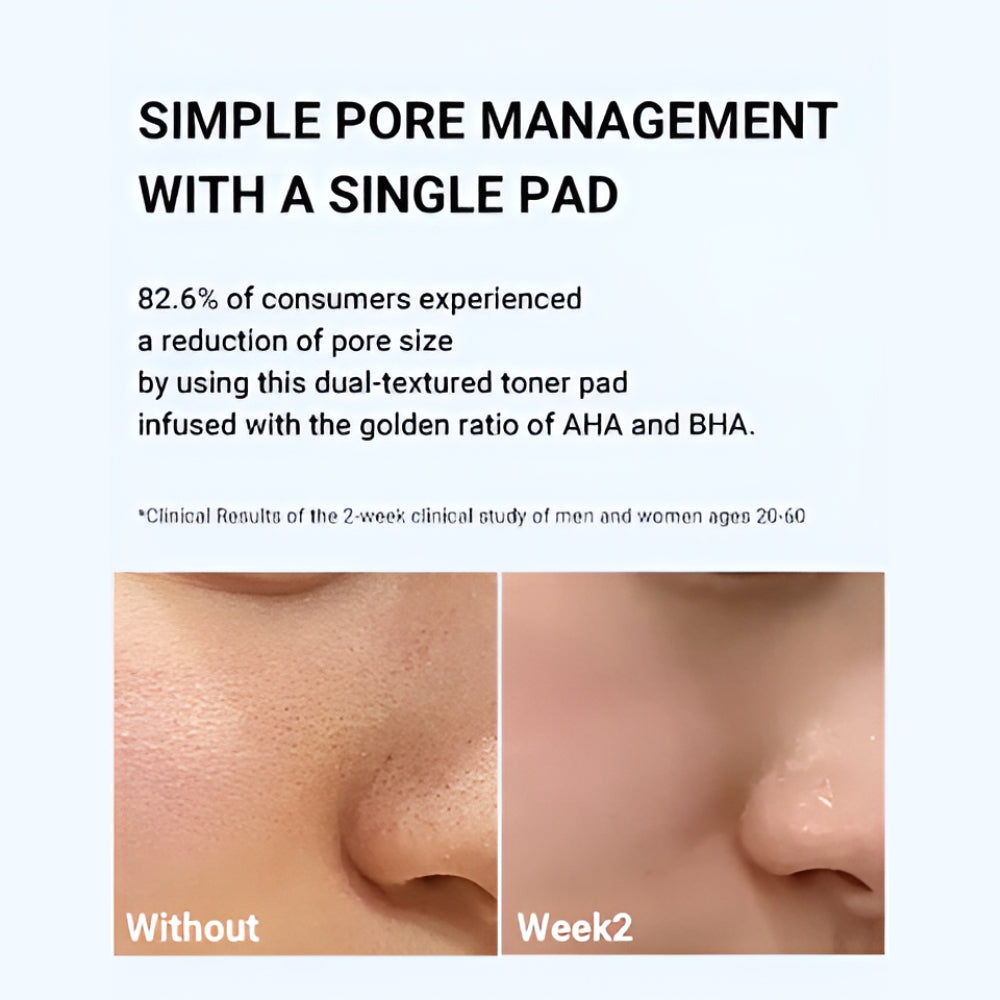 MEDICUBE Zero Pore Pad 2.0 Double Editions [Exclusive] - Pore Minimizing Skincare Set - 70 Pads + Refill