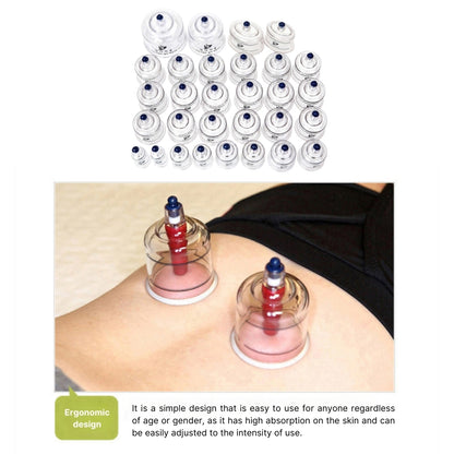 Hansol Buhang Korea 30 Cups Tempered Cupping Therapy Body Healthy Massager