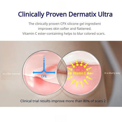 Dermatix Ultra Gel 7g - Advanced Scar Reduction Treatment