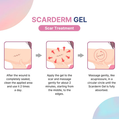 Scarderm Gel 10g, 20g Korea scar care after laser surgery, Removes Acne Blemish Scars, remove acne marks