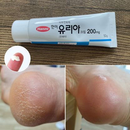 Hanmi Pharmaceutical Yuria Skin Softening Cream for Foot Care - Repellent Moisture for Eczema, Dry Feet - Housewives Dermatological Moisturizer