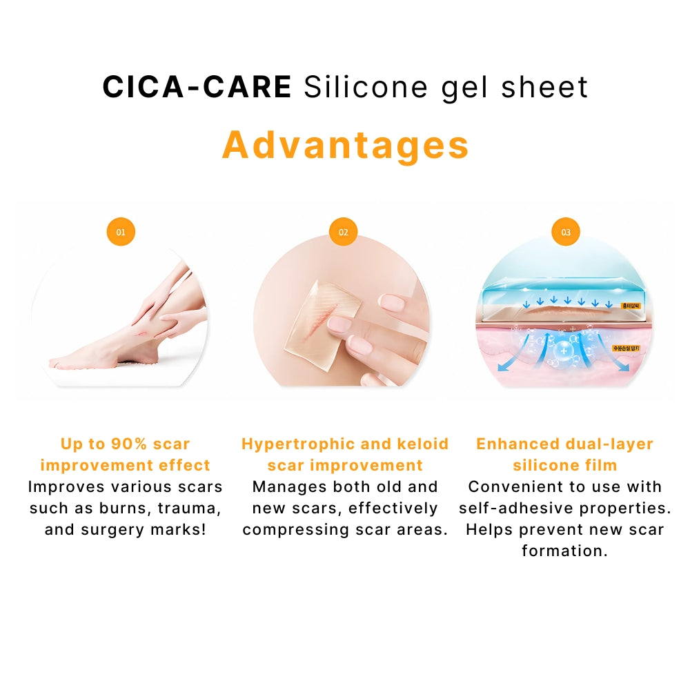 Smith & Nephew Cica Care Silicone Gel Sheet 12 x 3cm effective treatment for scars Scar Treatment